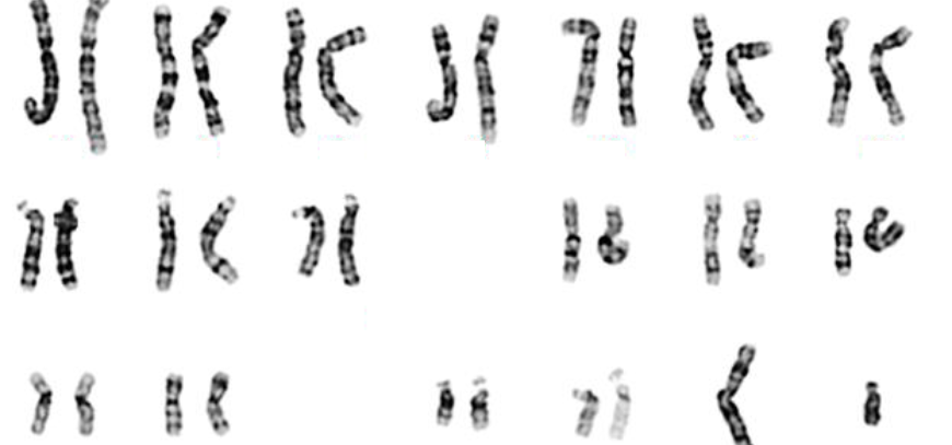 karyotyping_test_chennai